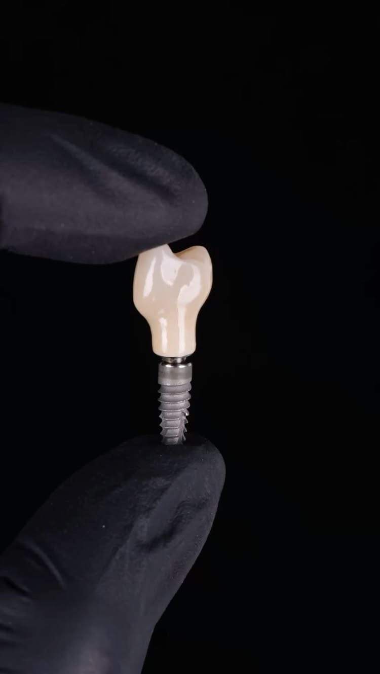 Имплантация зубов