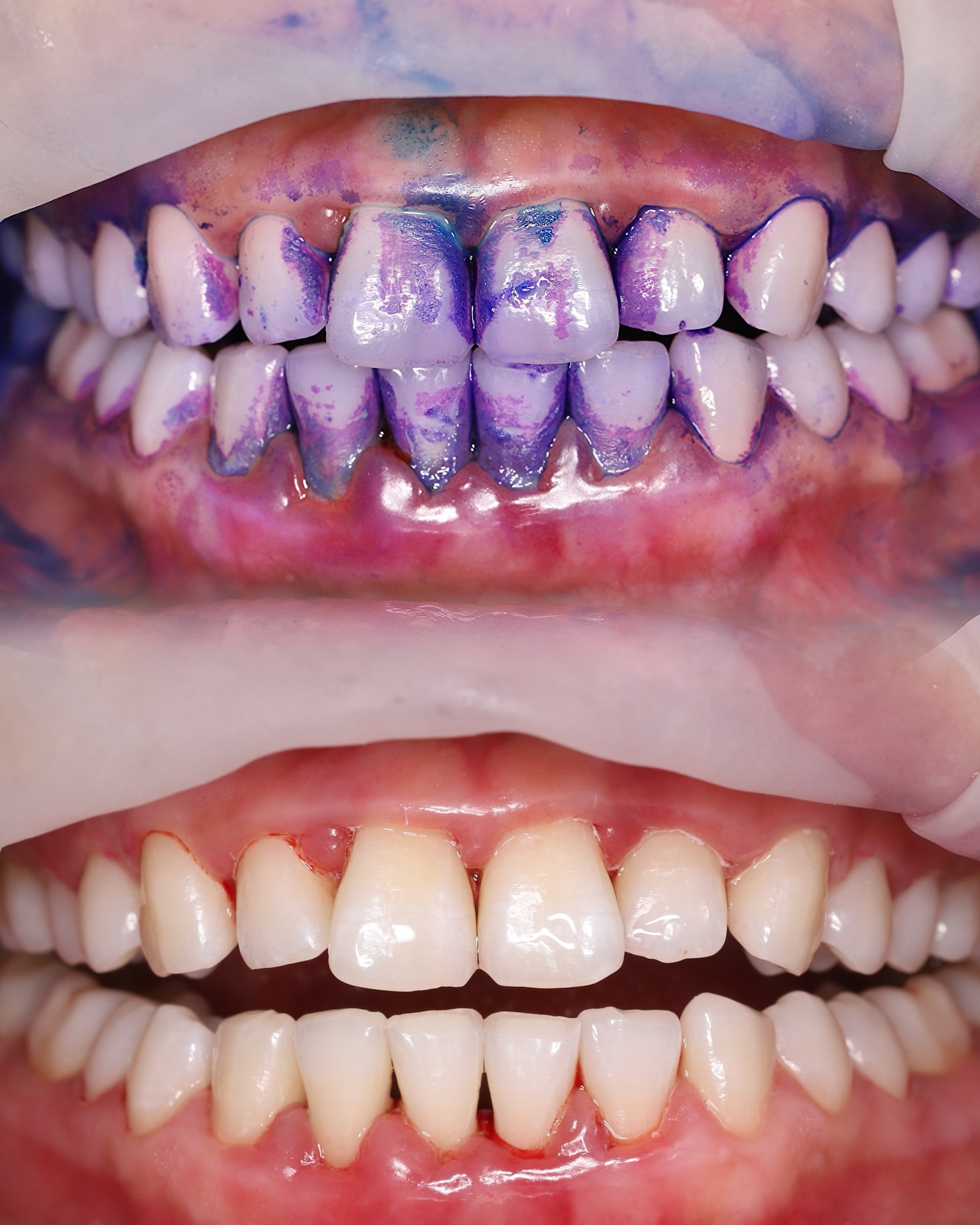 Профессиональная гигиена